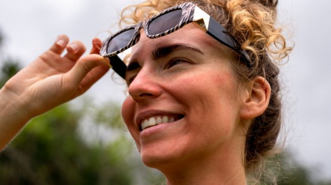 Jangan Anggap Sepele, Ini 4 Risiko Kerusakan Kulit dan Mata akibat Sunburn