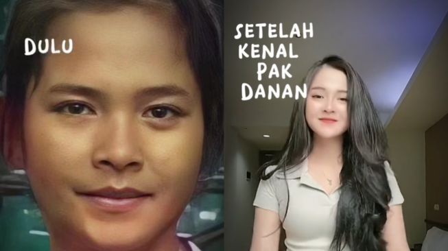 Before after wajah Bella Bonita usai dituding jadi simpanan suami orang. (TikTok/ @inspiration.4us)