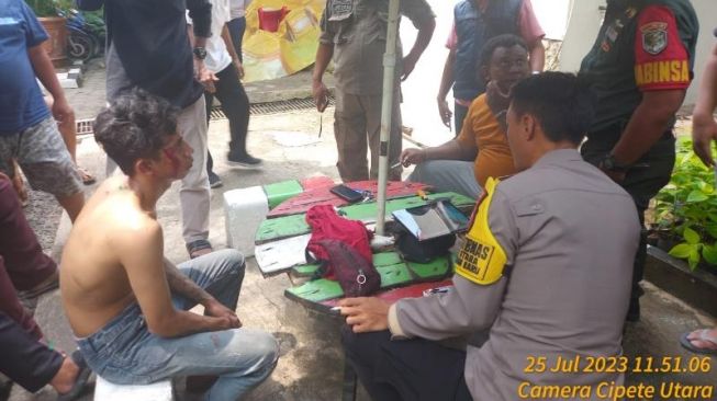 Ridho, pemuda bertato menjadi korban amuk warga karena dikira maling sepeda motor. (dok polisi)