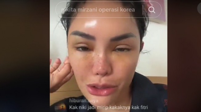 Pamer Hasil Oplas di Korea, Wajah Baru Nikita Mirzani Dibilang Kayak Transgender