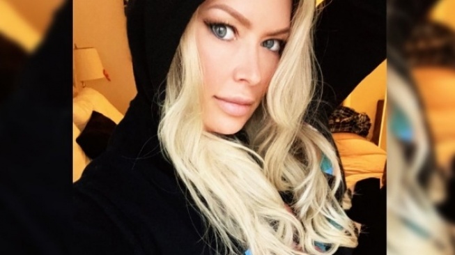 Kisah Tragis Artis Bokep Jenna Jameson, Berpenghasilan Rp226 M Tapi Kini Tak Bisa Berjalan Normal