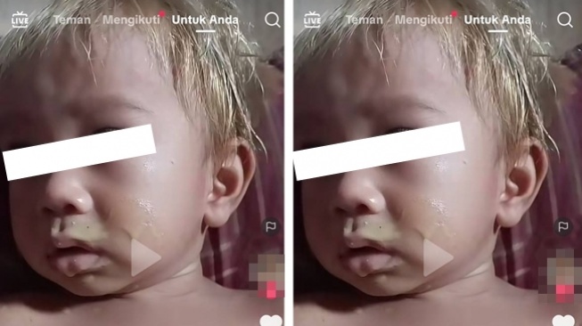 Duh! Ibu Nekat Bleaching Rambut Bayi 14 Bulan dan Ngotot Sudah BPOM, Netter Pusing: Gak Tertolong