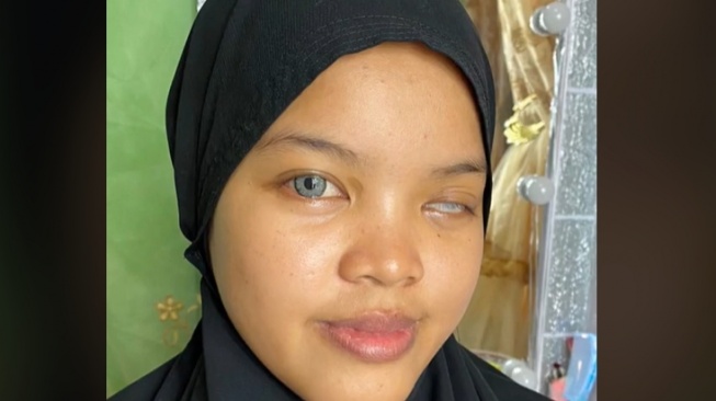 Skill Makeup Mumpuni, Begini Before After Pengantin Disabilitas Disulap Jadi Barbie