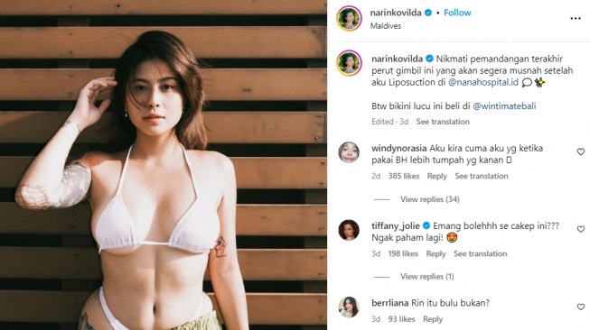 Awkarin sedot lemak alias liposuction. (Dok. Instagram)