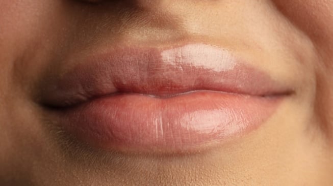 Jangan Skip, Ini 5 Tips Bibir Jadi Plumpy Natural Tanpa Harus Filler Bibir