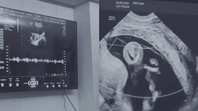 Momen Jessica Mila mengungkap dirinya hamil anak pertama (Instagram/@jscmila)