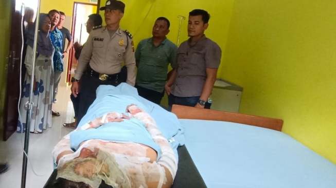 Cemburu Buta, Remaja di Langkat Bakar Istri Siri Hidup-hidup