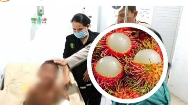 Gegara Habiskan Rambutan, Bocah 5 Tahun Ini Disetrika Tantenya Sendiri