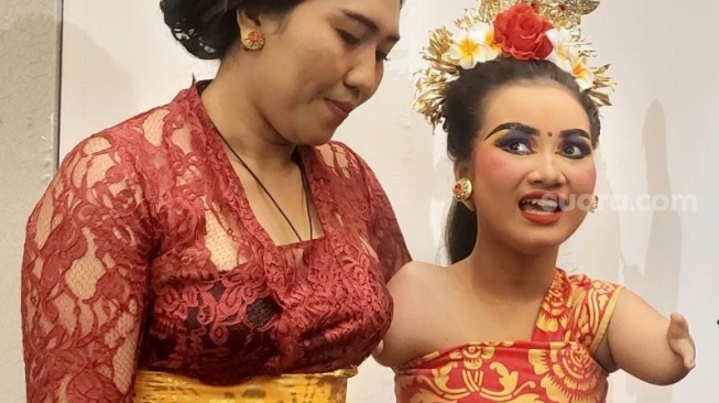 Kisah Gustiani Resya Iswaria, Penari Cilik Tanpa Tangan Memukau Dunia