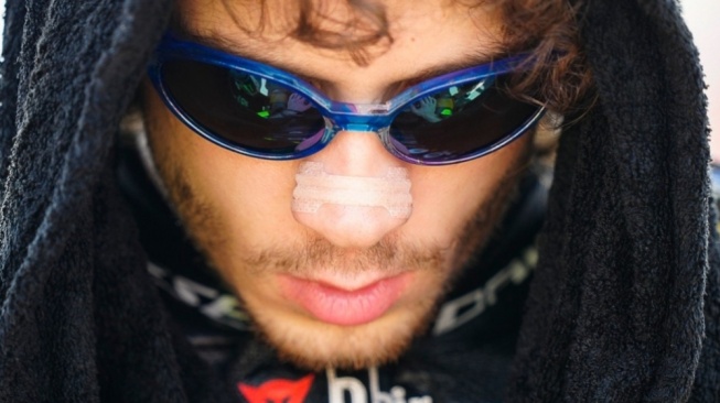 Potret Marco Bezzecchi pakai plester di hidung.(Instagram/@motogp)