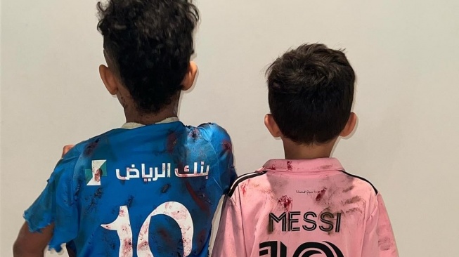 Dandani Anak Pakai Jersey Bola dengan Tubuh Penuh Luka untuk Kostum