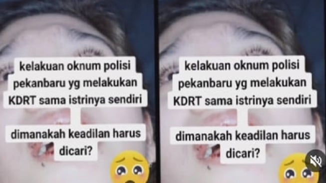 Heboh Ibu Bhayangkari Pekanbaru Ngaku Korban KDRT: Betapa Stres dan Gilanya Saya