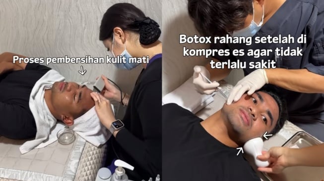 Pantes Makin Glowing, Asnawi Mangkualam Rajin Perawatan Wajah di Korea: Lakukan Botox Dahi dan Rahang!