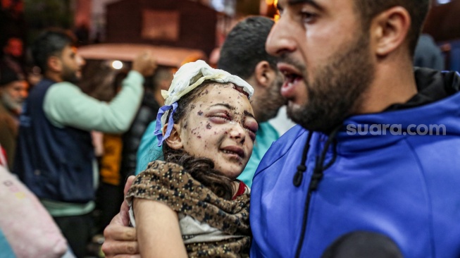 Warga Palestina yang terluka dan dievakuasi dari Rumah Sakit Indonesia menerima perawatan di Rumah Sakit Al-Nasser di Kota Khan Yunis, Selatan Palestina, Senin (21/11/2023). [Suara.com/Alfian Winanto]