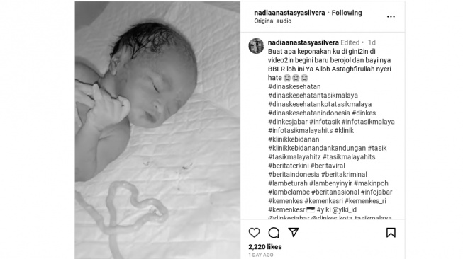 Tangkapan layar bayi prematur diduga dipaksa bikin konten newborn, yakni tali pusat dibentuk hati, di Klinik Alifa Tasikmalaya. (Instagram/@nadiaanastasyasilvera)