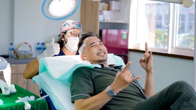 Piyu Padi melakukan transplantasi rambut. [Instagram]