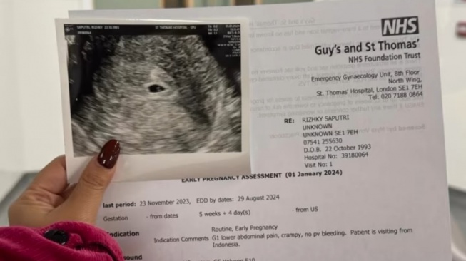 Kiky Saputri mengumumkan kehamilannya di rumah sakit Guy's dan St Thomas di Inggris.  (Instagram)