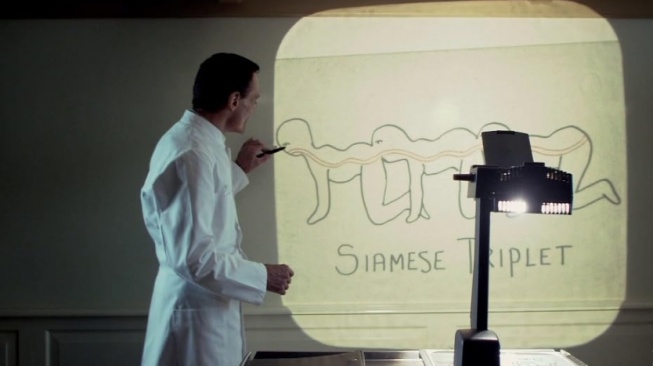 Sinopsis The Human Centipede. (IMDb)