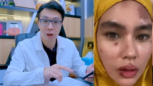 Prediksi Akurat, Richard Lee Ungkap Penyebab Kartika Putri Sakit: Bisa Jadi Pakai Skincare Abal-abal