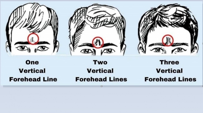 Tes Kepribadian Cari Tahu Sifat Seseorang Lewat Garis Dahinya