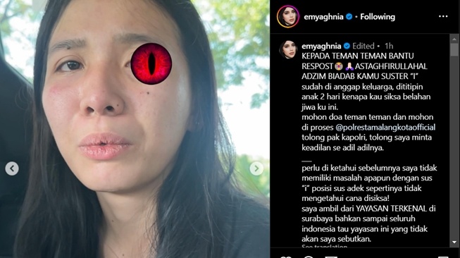 Pengasuh yang diduga menganiaya anak Aghnia Punjabi (Instagram)