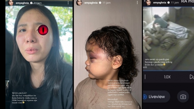 Penganiayaan kepada anak Aghnia Punjabi yang diduga dilakukan pengasuhnya (Instagram/emyaghnia)