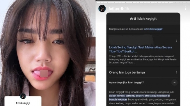 Fuji Tak Sengaja Gigit Lidahnya Sendiri. [Instagram]