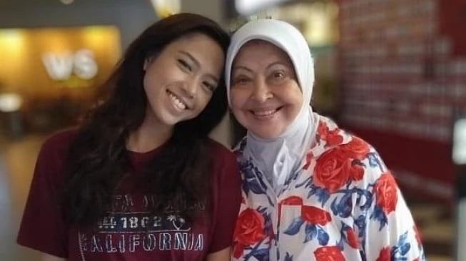 Potret Nicole Christy Anak Angkat Nia Zulkarnaen dan Ari Sihasale. (Instagram/nicolechristy.o)