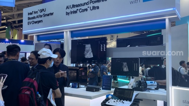 Intel memperkenalkan ultrasound dengan kecanggihan AI di Computex Expo 2024 di Nangang Exhibition Center, Taipei, Selasa (4/6/2024). [Suara.com/Ria]