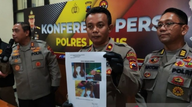 Duh! Hukum Santri Sampai Tangannya Melepuh, Pengurus Ponpes di Kudus Terancam Dijebloskan ke Penjara