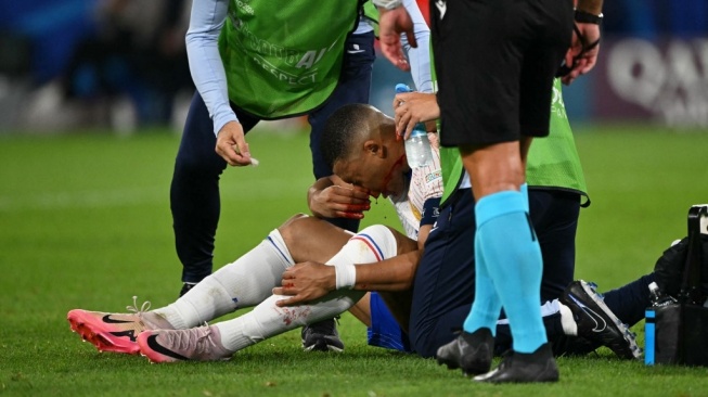 Penyerang timnas Prancis, Kylian Mbappe menerima perawatan medis setelah cedera hidung selama pertandingan pertama Grup D Euro 2024 antara Austria vs Prancis di Duesseldorf Arena di Duesseldorf pada 17 Juni 2024.OZAN KOSE / AFP.