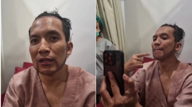 Desta Lakukan Transplantasi Rambut di Klinik Dokter Tompi, Berapa Biayanya?