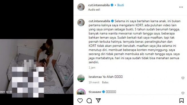 Cut Intan Nabila dianiaya suami sendiri [Instagram/@cut.intannabila]