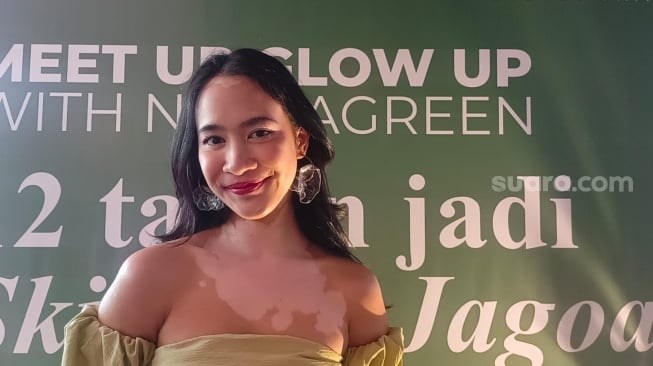 Percaya Diri dengan Vitiligo, Salma Kyana Ungkap Makna Kecantikan