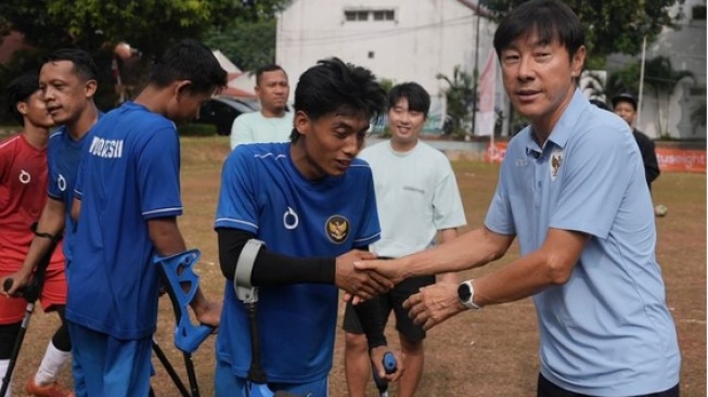 Terharu! Shin Tae Yong Kunjungi TC Sepak Bola Amputasi, Begini Komentarnya