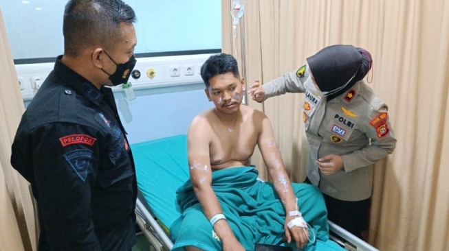 Anggota Brimob Kena Siram Air Keras Saat Bubarkan Taruwan Di Jatinegara, Pelaku Diburu