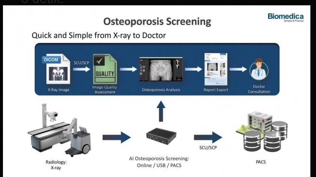 OsteoCloud dirancang untuk menyederhanakan proses deteksi dan diagnosis osteoporosis [Suara.com/PEROSI]