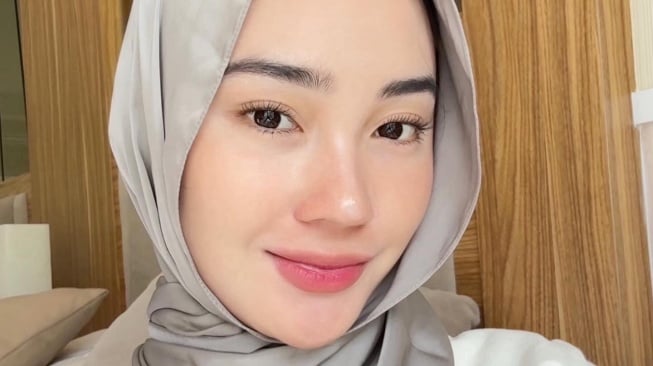 Nama Selebgram Dinda Rimby terseret dalam isu skandal perselingkuhan. (IG Dinda Rimby)