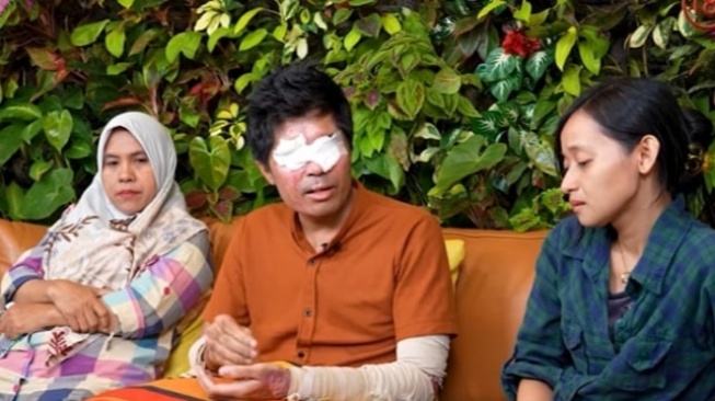 Agus Salim korban penyiraman air keras (YouTube/Curhat Bang Denny Sumargo)