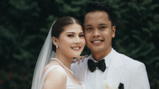 Intip Gaya Fashion Mitzi Abigail Purnama, Istri Anthony Ginting yang Stylish Abis