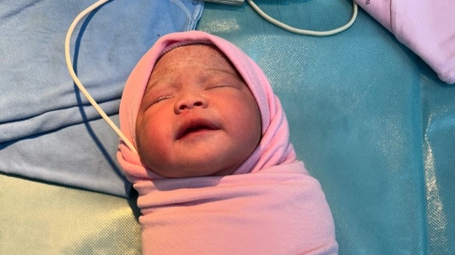 Istri Ello melahirkan anak ke-2 (Instagram)