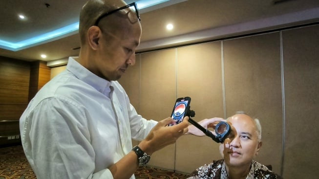 Cegah Kebutaan Akibat Diabetes, Peneliti UGM Ciptakan Kamera Fundus Berbasis Smartphone