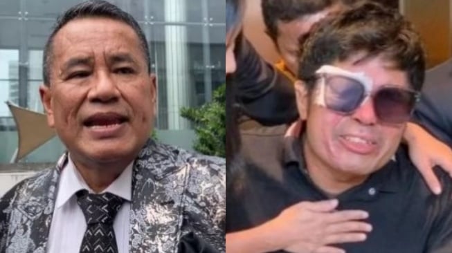 Berlawanan dengan Denny Sumargo, Hotman Paris Sebut Uang Donasi Tetap Jadi Hak Agus