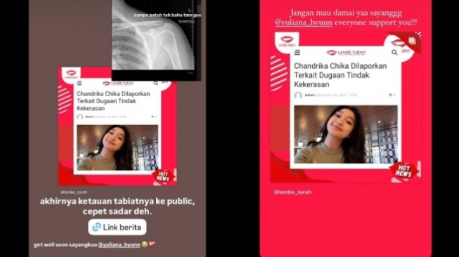 Unggahan diduga korban penganiayaan Chandrika Chika (Instagram/yuliana_byunn)