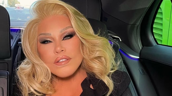 Jelang Tahun Baru, Ratu Oplas Jocelyn Wildenstein 'Cat Woman' Meninggal Dunia