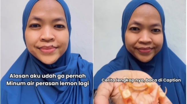 Viral gigi rontok karena sering minum perasan jeruk dan lemon. (Foto: Instagram)