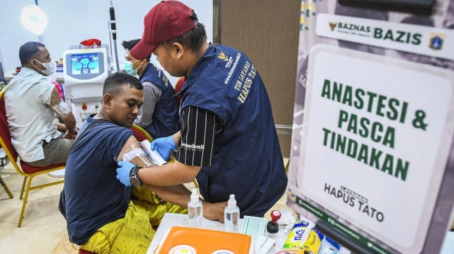 Ingat Larangan Ibu dan Malu dengan Anak, Raike Manfaatkan Program Hapus Tato Gratis