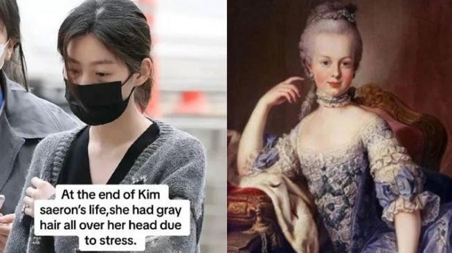 Mengenal Sindrom Marie Antoinette, Diduga Dialami Kim Sae Ron sebelum Meninggal