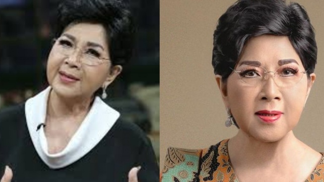 Bahaya dan Penyebab Pendarahan Otak, Dialami Titiek Puspa Saat Kritis hingga Meninggal Dunia!