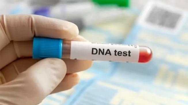 Prosedur Tes DNA, Diminta Lisa Mariana untuk Buktikan Status Anak